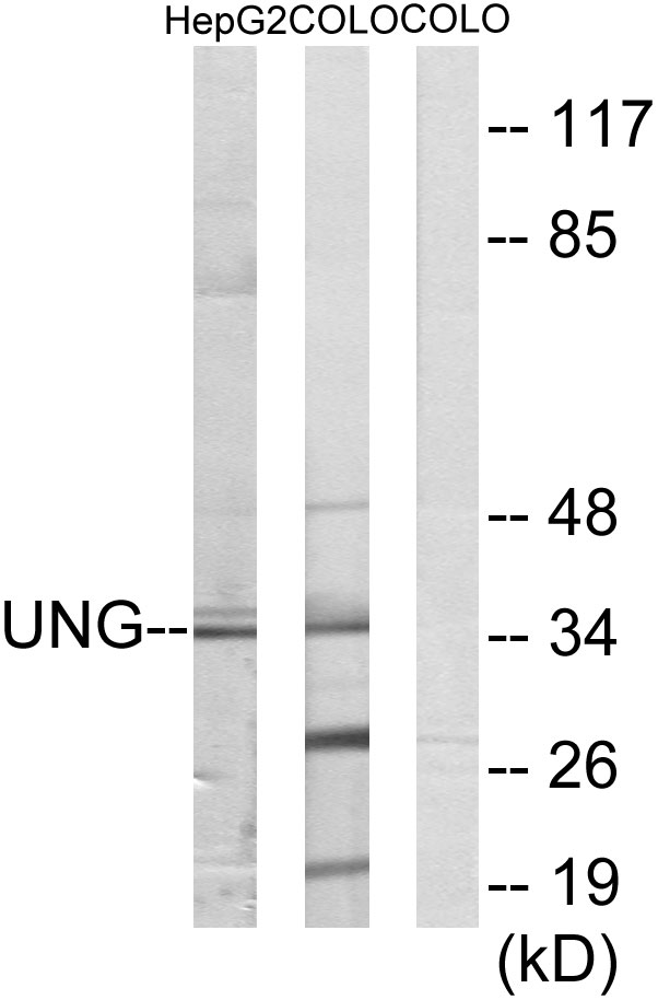 UNG / Uracil DNA Glycosylase Antibody - Western blot analysis of lysates from HepG2 and COLO cells, using UNG Antibody. The lane on the right is blocked with the synthesized peptide.