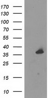 UNG / Uracil DNA Glycosylase Antibody - HEK293T cells were transfected with the pCMV6-ENTRY control (Left lane) or pCMV6-ENTRY UNG (Right lane) cDNA for 48 hrs and lysed. Equivalent amounts of cell lysates (5 ug per lane) were separated by SDS-PAGE and immunoblotted with anti-UNG.
