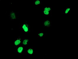 UNG / Uracil DNA Glycosylase Antibody - Anti-UNG mouse monoclonal antibody immunofluorescent staining of COS7 cells transiently transfected by pCMV6-ENTRY UNG.