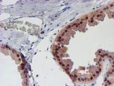 UNG / Uracil DNA Glycosylase Antibody - IHC of paraffin-embedded Human breast tissue using anti-UNG mouse monoclonal antibody.