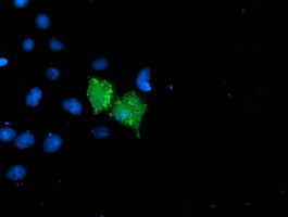 UNG / Uracil DNA Glycosylase Antibody - Anti-UNG mouse monoclonal antibody immunofluorescent staining of COS7 cells transiently transfected by pCMV6-ENTRY UNG.