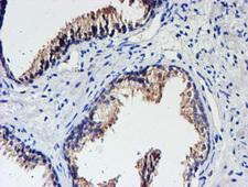 UNG / Uracil DNA Glycosylase Antibody - IHC of paraffin-embedded Human prostate tissue using anti-UNG mouse monoclonal antibody. (Heat-induced epitope retrieval by 10mM citric buffer, pH6.0, 100C for 10min).