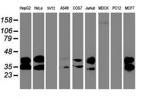 UNG / Uracil DNA Glycosylase Antibody - Western blot of extracts (35 ug) from 9 different cell lines by using anti-UNG monoclonal antibody.