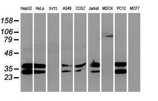 UNG / Uracil DNA Glycosylase Antibody - Western blot of extracts (35ug) from 9 different cell lines by using anti-UNG monoclonal antibody.