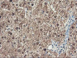 UNG / Uracil DNA Glycosylase Antibody - IHC of paraffin-embedded Human liver tissue using anti-UNG mouse monoclonal antibody. (Heat-induced epitope retrieval by 10mM citric buffer, pH6.0, 100C for 10min).