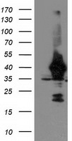 UNG / Uracil DNA Glycosylase Antibody - HEK293T cells were transfected with the pCMV6-ENTRY control (Left lane) or pCMV6-ENTRY UNG (Right lane) cDNA for 48 hrs and lysed. Equivalent amounts of cell lysates (5 ug per lane) were separated by SDS-PAGE and immunoblotted with anti-UNG.