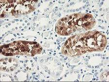 UNG / Uracil DNA Glycosylase Antibody - IHC of paraffin-embedded Human Kidney tissue using anti-UNG mouse monoclonal antibody. (Heat-induced epitope retrieval by 10mM citric buffer, pH6.0, 100C for 10min).
