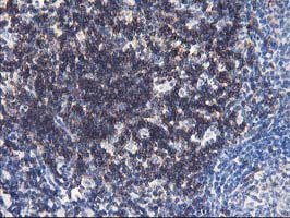 UNG / Uracil DNA Glycosylase Antibody - IHC of paraffin-embedded Human tonsil using anti-UNG mouse monoclonal antibody. (Heat-induced epitope retrieval by 10mM citric buffer, pH6.0, 100C for 10min).