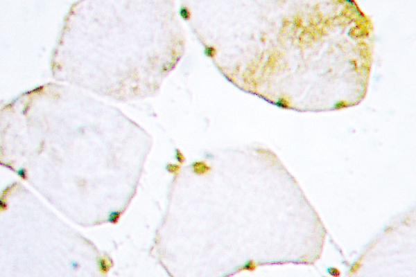 UNG / Uracil DNA Glycosylase Antibody - IHC of UDG (H221) pAb in paraffin-embedded human skeletal muscle tissue.