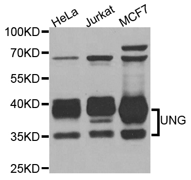 UNG / Uracil DNA Glycosylase Antibody - Western blot analysis of extracts of various cell lines, using UNG antibody at 1:1000 dilution. The secondary antibody used was an HRP Goat Anti-Rabbit IgG (H+L) at 1:10000 dilution. Lysates were loaded 25ug per lane and 3% nonfat dry milk in TBST was used for blocking. An ECL Kit was used for detection and the exposure time was 5s.