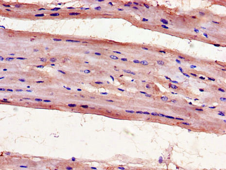 UNG / Uracil DNA Glycosylase Antibody - Immunohistochemistry of paraffin-embedded human heart tissue using UNG Antibody at dilution of 1:100