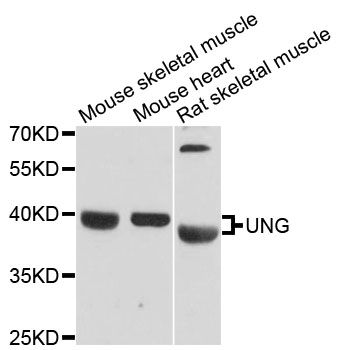 UNG / Uracil DNA Glycosylase Antibody - Western blot analysis of extracts of various cell lines, using UNG antibody at 1:3000 dilution. The secondary antibody used was an HRP Goat Anti-Rabbit IgG (H+L) at 1:10000 dilution. Lysates were loaded 25ug per lane and 3% nonfat dry milk in TBST was used for blocking. An ECL Kit was used for detection and the exposure time was 90s.