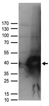 UNG / Uracil DNA Glycosylase Antibody - HEK293T cells were transfected with the pCMV6-ENTRY control. (Left lane) or pCMV6-ENTRY UNG. (Right lane) cDNA for 48 hrs and lysed