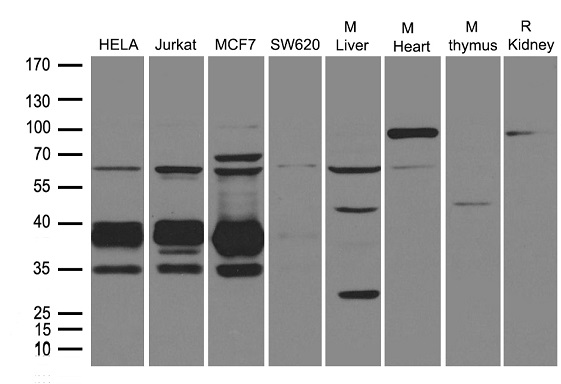 UNG / Uracil DNA Glycosylase Antibody - Western blot analysis of extracts. (35ug) from different cell lines or tissues by using anti-UNG rabbit polyclonal antibody .