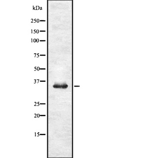 UNG / Uracil DNA Glycosylase Antibody - Western blot analysis UNG using RAW264.7 whole cells lysates