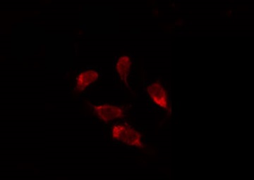 UNG / Uracil DNA Glycosylase Antibody - Staining HeLa cells by IF/ICC. The samples were fixed with PFA and permeabilized in 0.1% Triton X-100, then blocked in 10% serum for 45 min at 25°C. The primary antibody was diluted at 1:200 and incubated with the sample for 1 hour at 37°C. An Alexa Fluor 594 conjugated goat anti-rabbit IgG (H+L) Ab, diluted at 1/600, was used as the secondary antibody.
