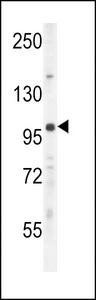 UNK Antibody - UNK Antibody western blot of mouse lung tissue lysates (35 ug/lane). The UNK antibody detected the UNK protein (arrow).