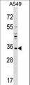 UNKL Antibody - UNKL Antibody western blot of A549 cell line lysates (35 ug/lane). The UNKL antibody detected the UNKL protein (arrow).