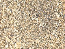 UNKL Antibody - Immunohistochemistry of paraffin-embedded Human tonsil tissue  using UNKL Polyclonal Antibody at dilution of 1:50(×200)