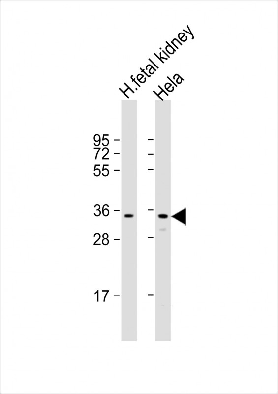 UP / UPP1 Antibody - All lanes: Anti-UPP1 Antibody (C-Term) at 1:2000 dilution Lane 1: human fetal kidney lysate Lane 2: Hela whole cell lysate Lysates/proteins at 20 µg per lane. Secondary Goat Anti-Rabbit IgG, (H+L), Peroxidase conjugated at 1/10000 dilution. Predicted band size: 34 kDa Blocking/Dilution buffer: 5% NFDM/TBST.