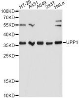 UP / UPP1 Antibody - Western blot analysis of extracts of various cell lines, using UPP1 Antibody at 1:3000 dilution. The secondary antibody used was an HRP Goat Anti-Rabbit IgG (H+L) at 1:10000 dilution. Lysates were loaded 25ug per lane and 3% nonfat dry milk in TBST was used for blocking. An ECL Kit was used for detection and the exposure time was 60s.