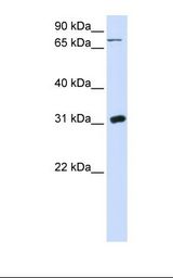 UP / UPP1 Antibody - 293T cell lysate. Antibody concentration: 1.0 ug/ml. Gel concentration: 12%.  This image was taken for the unconjugated form of this product. Other forms have not been tested.