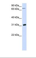 UP / UPP1 Antibody - 293T cell lysate. Antibody concentration: 1.0 ug/ml. Gel concentration: 12%.  This image was taken for the unconjugated form of this product. Other forms have not been tested.