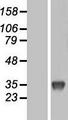 UP / UPP1 Protein - Western validation with an anti-DDK antibody * L: Control HEK293 lysate R: Over-expression lysate