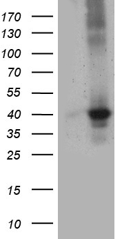 UP2 / UPP2 Antibody - HEK293T cells were transfected with the pCMV6-ENTRY control. (Left lane) or pCMV6-ENTRY UPP2. (Right lane) cDNA for 48 hrs and lysed