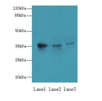 UP2 / UPP2 Antibody - Western blot. All lanes: UPP2 antibody at 4 ug/ml. Lane 1: Mouse kidney tissue. Lane 2: Mouse brain tissue. Lane 3: HeLa whole cell lysate. Secondary antibody: Goat polyclonal to Rabbit IgG at 1:10000 dilution. Predicted band size: 36 kDa. Observed band size: 36 kDa.