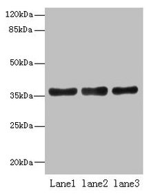 UP2 / UPP2 Antibody - Western blot All lanes: UPP2 antibody at 4µg/ml Lane 1: Mouse kidney tissue Lane 2: Mouse brain tissue Lane 3: Hela whole cell lysate Secondary Goat polyclonal to rabbit IgG at 1/10000 dilution Predicted band size: 36, 42 kDa Observed band size: 36 kDa