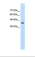 UPB1 Antibody - Jurkat cell lysate. Antibody concentration: 2.5 ug/ml. Gel concentration: 12%.  This image was taken for the unconjugated form of this product. Other forms have not been tested.