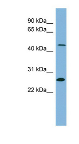 UPB1 Antibody - UPB1 antibody Western blot of PANC1 cell lysate. This image was taken for the unconjugated form of this product. Other forms have not been tested.