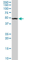 UPB1 Antibody - UPB1 monoclonal antibody (M09), clone 3F12. Western blot of UPB1 expression in human liver.