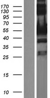 UPF3A / UPF3 Protein - Western validation with an anti-DDK antibody * L: Control HEK293 lysate R: Over-expression lysate