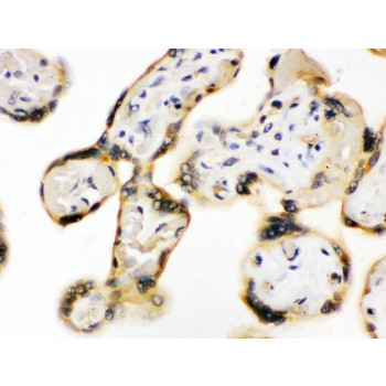 UPF3B Antibody - UPF3B/RENT3B antibody IHC-paraffin. IHC(P): Human Placenta Tissue.