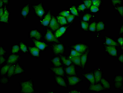 UPF3B Antibody - Immunofluorescence staining of Hela cells diluted at 1:166, counter-stained with DAPI. The cells were fixed in 4% formaldehyde, permeabilized using 0.2% Triton X-100 and blocked in 10% normal Goat Serum. The cells were then incubated with the antibody overnight at 4°C.The Secondary antibody was Alexa Fluor 488-congugated AffiniPure Goat Anti-Rabbit IgG (H+L).