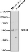 UPF3B Antibody - Western blot analysis of extracts of various cell lines, using UPF3B antibody at 1:1000 dilution. The secondary antibody used was an HRP Goat Anti-Rabbit IgG (H+L) at 1:10000 dilution. Lysates were loaded 25ug per lane and 3% nonfat dry milk in TBST was used for blocking. An ECL Kit was used for detection and the exposure time was 10s.