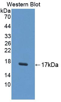 UPK1A / Uroplakin 1A Antibody - Western blot of UPK1A / Uroplakin 1A antibody.