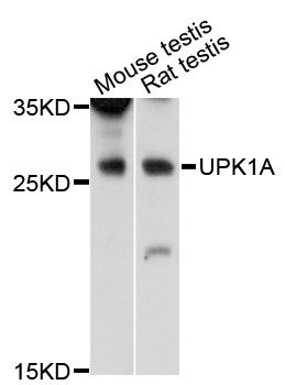 UPK1A / Uroplakin 1A Antibody - Western blot analysis of extracts of various cell lines, using UPK1A antibody at 1:3000 dilution. The secondary antibody used was an HRP Goat Anti-Rabbit IgG (H+L) at 1:10000 dilution. Lysates were loaded 25ug per lane and 3% nonfat dry milk in TBST was used for blocking. An ECL Kit was used for detection and the exposure time was 30s.