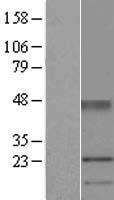 UPK1A / Uroplakin 1A Protein - Western validation with an anti-DDK antibody * L: Control HEK293 lysate R: Over-expression lysate
