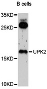 UPK2 / UPII / Uroplakin 2 Antibody - Western blot analysis of extracts of B-cell cells, using UPK2 antibody at 1:1000 dilution. The secondary antibody used was an HRP Goat Anti-Rabbit IgG (H+L) at 1:10000 dilution. Lysates were loaded 25ug per lane and 3% nonfat dry milk in TBST was used for blocking. An ECL Kit was used for detection and the exposure time was 40s.