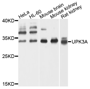 UPK3A / UPK3 / Uroplakin III Antibody - Western blot analysis of extracts of various cell lines, using UPK3A antibody at 1:1000 dilution. The secondary antibody used was an HRP Goat Anti-Rabbit IgG (H+L) at 1:10000 dilution. Lysates were loaded 25ug per lane and 3% nonfat dry milk in TBST was used for blocking. An ECL Kit was used for detection and the exposure time was 5s.