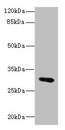 UPK3A / UPK3 / Uroplakin III Antibody - Western blot All Lanes: UPK3A antibody IgG at 1.76ug/ml+ Mouse lung tissue Secondary Goat polyclonal to rabbit IgG at 1/10000 dilution Predicted band size: 31,18 kDa Observed band size: 31 kDa