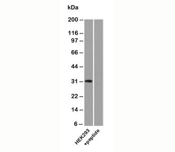 UPK3A / UPK3 / Uroplakin III Antibody - Uroplakin 3A antibody western blot.  This image was taken for the unmodified form of this product. Other forms have not been tested.