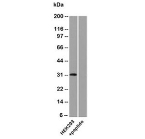UPK3A / UPK3 / Uroplakin III Antibody - Western blot analysis of human HEK293 lysate using Uroplakin 3A antibody.