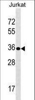 UPK3B Antibody - UPK3B Antibody western blot of Jurkat cell line lysates (35 ug/lane). The UPK3B antibody detected the UPK3B protein (arrow).