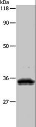 UPK3B Antibody - Western blot analysis of 293T cell, using UPK3B Polyclonal Antibody at dilution of 1:1000.