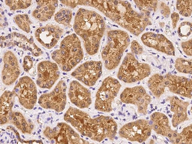 UPK3B Antibody - Immunochemical staining of human UPK3B in human kidney with rabbit polyclonal antibody at 1:100 dilution, formalin-fixed paraffin embedded sections.
