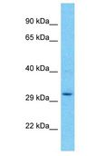 UPLP Antibody - UPK3BL antibody Western Blot of 721_B. Antibody dilution: 1 ug/ml.  This image was taken for the unconjugated form of this product. Other forms have not been tested.